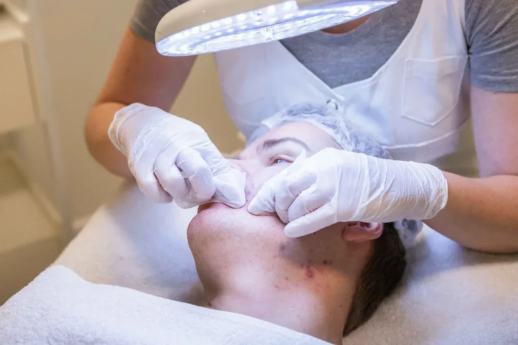 Acnebehandeling bij Dermavita Huidtherapie in Zaandam Acnebehandeling bij Dermavita Huidtherapie in Zaandam