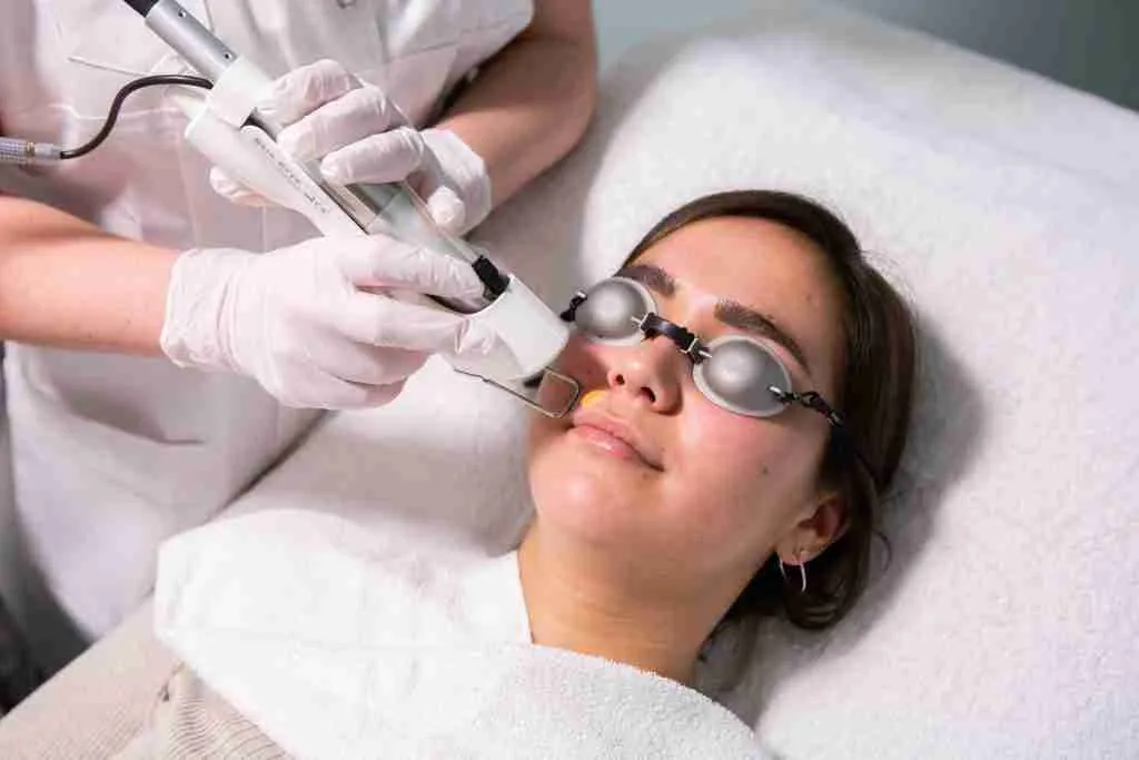 Ontharingsbehandeling bij Dermavita Huidtherapie in Zaandam